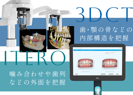 3DCT：歯・顎の骨などの内部構造を把握、iTero：噛み合わせや歯列などの外面を把握