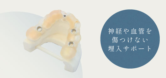 神経や血管を傷つけない埋入サポート